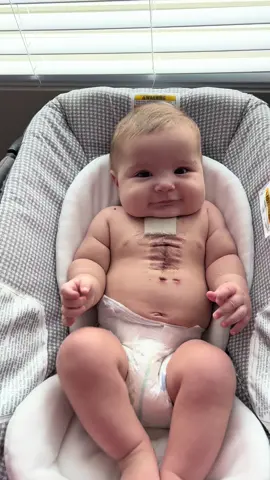 my brave, strong, smart, and oh so sweet baby boy 🫶🏼 #heartwarrior #tetralogyoffallotbaby #tetralogyoffallot #pulmonaryatresia #chdawareness #TOFlikeRemi #baby #toddler #fyp #foryoupage #fypシ 