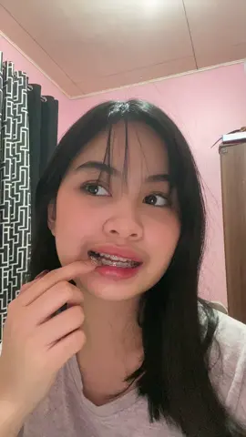 tinga check 🤪