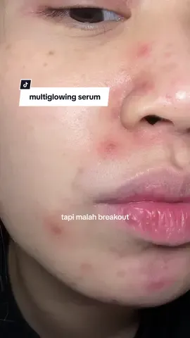 Serum for a multi glowing skin in a bottle! cocok di bawa traveling :) siapa yang udah pernah cobainnn? #serum #brightening #multiglowing #erhatruwhite @ERHA Truwhite Official Store 
