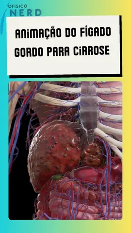 Animação do fígado gordo para cirrose #fisica #science #saude 