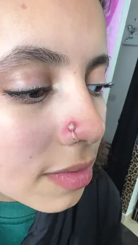 Infezione nostril #infezionenostril#piersing#piercingshein #nostril#perte 