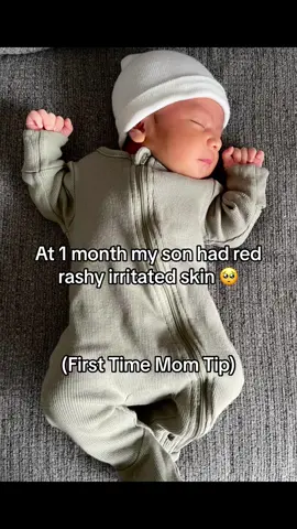 Every babys skin is different, but this worked for us 🫶🏼🤍 Thank you @Tubby Todd  #fyp #alloverointment #babiesoftiktok 