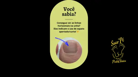 Suav'Pé Podoclínica Profissional capacitada com mais de 30 anos de experiência na área podológica. O tratamento adequado para seus pés.  #suavpe #podologiaJoinville #podologiaésaúde #podologiasaúdeparaseuspés #cuidadocomospés