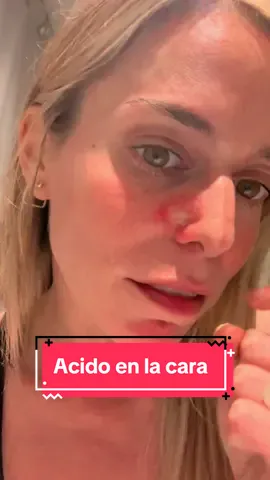 #skincare cuando sale MUY mal.  Alguna recomendación ? #tristefinal #cosmetics #dermatology #peeling #peelingskin #skincareroutine #skincaretips #prodermic #dadatina #ayuda #storytime 