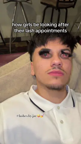 like are y’all okay bro what are them estheticians putting in yalls eyes 😂😂