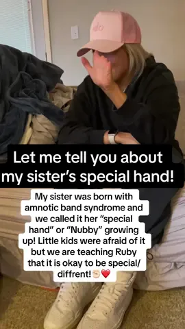 My sister was born with amnotic band syndrome and we called it her “special hand” or “Nubby” growing up! Little kids were afraid of it but we are teaching Ruby that it is okay to be special/diffrent!✊🏻❤️ #nub #nubby #special #amnioticbandsyndrome #toddler #toddersoftiktok #momtok #momlife #momtiktok #auntiesoftiktok #auntlifeisthebestlife #auntlife #myhero #besties #besite #sister #sistergoals @Bailey Homann 