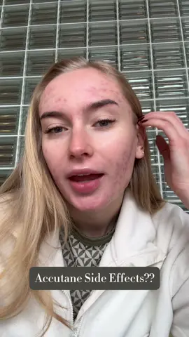 Forgot to mention that my back is also not the best, need to hit the orthopedic doc asap😂😂😂😂 #acne #newyork #nyc #newyorkcity #nyccontentcreator #contentcreator #goals #nycinfluencer #accutane #insecurity #anxiety #columbia #columbiastudent #columbiauniversity #motivation #wellness #skincare #relatable #skincaretips #accutanejourney #accutanediary #selflove #confidence #bodypositivity 