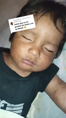 Respuesta a @gabbie_mdd mis verdaderos dientecitos 🦷🦷☺️👶🏻💜 la producción estaba esperando mucho por mis dientitos 🥰 pero ahora le muerdo 🦈😁🤭🫣 la producción quedo 🥹🤡😩 #liam_vc #bebes #maternidad #tiburoncin #parati #humor #cute #babys #diente #babyblogger #bebestiktoks #babytiktok  #maternidadecomhumor #primerosdientes 