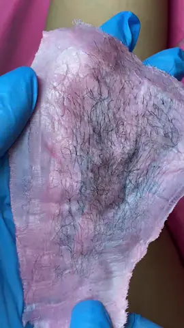 Underarm wax time-lapse 🤩 Book me for amazing long lasting results ✨ #fyp #foryou #viral #esthetician #londonsalon #estheticianlife #estheticiantiktok #oddlysatisfying #southlondonbased #londonbased #waxing #waxingvideos #oddlysatisfyingvideo #wax #underarmwax #underarmwaxing #waxinginlondon #southlondonwaxer #southlondonwaxes #southlondonwaxing #newcrossbeauty 