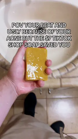 #acnetreatment #facewash #skincare 