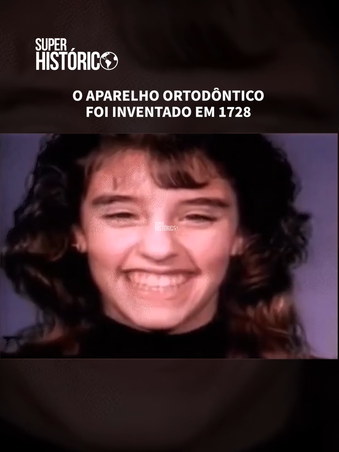 O APARELHO ORTODÔNTICO FOI INVENTADO EM 1728
