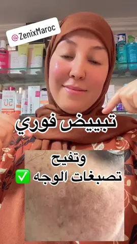 #تبيض_فوري #تبييض #تبييض_بشرة #تبييض_المناطق_الحساسة #تفتيح #تفتيح_البشرة #تفتيح_الجسم #تفتيح_المناطق_الداكنة #تفتيح_الركب_الاكواع #تبيض_وتفتيح_تحت_الابط #تبيض_اليدين_والرجلين #تبيض_الوجة #نضارة_البشرة #نضارة #@Zenix Maroc #zenix #eclair #eclaircissant #اشراقة #تفتيح_الركب #بياض #جمال #صحة #عنايه #عناية_بالبشرة #روتيني_اليومي #روتين #skincare #skincareroutine #girl #تصبغات #تصبغات_الوجه #الدسة #كلف #كلف_نمش #البقعه #البقع_الداكنة_وتوحيد_لون_البشرة #توحيد #توحيد_لون_الجسم #تصبغات_البشره #fyp #fypシ #fypシ゚viral #viral #viraltiktok #viralvideo #tiktok #foryou #foryoupage #trending #explore #explor #maroco🇲🇦algeria🇩🇿tunisia🇹🇳 #parfumerie_amina #حركة_الاكسبلور #اكسبلور #اكسبلورexplore #الشعب_الصيني_ماله_حل😂😂 #مشاهير_تيك_توك #تيك_توك #مشاهدات #مشاهير #المغرب🇲🇦تونس🇹🇳الجزائر🇩🇿 #المغربيات_أجمل_نساء_الكون🇲🇦مغربية #المغرب🇲🇦تونس🇹🇳الجزائر🇩🇿تركيا🇹🇷_العراق🇮🇶 #الخليج_العربي_اردن_عمان_مصر_تونس_المغرب #عطور_أمينة 