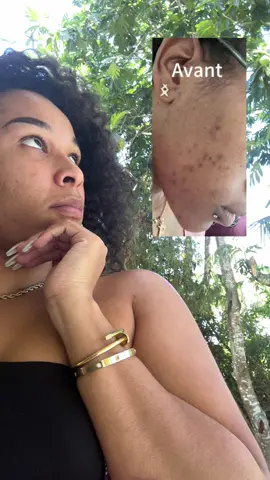 Vous avez des problèmes de tâches ?🤔 Ryrouvez les produits sur gaentreprise.com et bénéficiez de -15% avec le code MARS jusqu’à ce soir 😍  #fyp #fy 