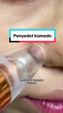 Penyedot komedo dari winland , hisapannya kenceng banget , dengan 6 kepala hisap  #penyedotkomedo #vakumkomedo #winlanddisampingmu #RamadanEkstraSeru 