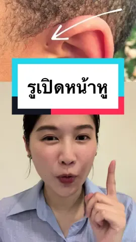 รูเปิดหน้าหู อันตรายมั้ย?#หมอหูคอจมูก #หมอธัญ #earpit #preauricularsinus #รูหน้าหู 