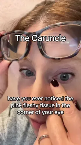 But what’s it for 😭 #caruncle #lacrimal #eye #anatomy #eyes #optometry #optometryschool #optometrystudent #optometrist #preoptometry #prehealth #vestigial #greenscreen 