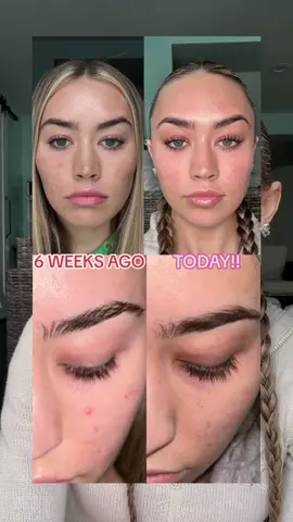 The results speak for itself 🤩 #lashtherapyaustralia #lashgrowth #realresults #lashserum 