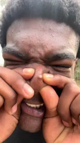 It just wont pop 🤦🏾‍♂️ #viral #meme #tiktok #fyp 