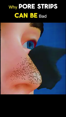 Why Pore Strips Can Be Bad? 3d Medical animation #pore  #strip #porestrip  #porestripremoval #blackpimple #blackpimples #pimpleremoval #porestrips #porestripsremoval #medicalanimation #pimple  #pimples  