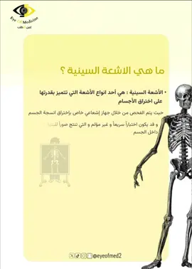 كيفية اكتشاف الأشعة السينية!☢️ #fyp #أشعة #عين_الطب #xray #medical #طب 