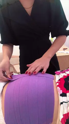 E aí, mamãe, já ouviu falar do benefícios do taping no pós-parto? 💕 #taping  #tapingposparto #fisiopelvicamaraba #fisioterapiaobstetrica