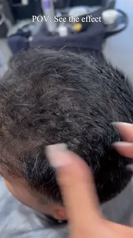 If you are worried about baldness, I highly recommend you to use this product👏👏#sevich 