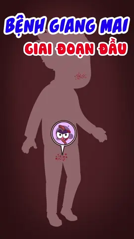 Giang mai giai đoạn đầu #giangmai #benhxahoi #benhtinhduc