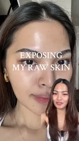 Normalizing skin struggles, but never skimping on protection! 💪🏼 With #CeletequeSoftMatteMoisturizer my skin is protected from skin-damaging factors! It’s NOT just your ordinary moisturizer 🙌🏼 #SunProtectionPlus