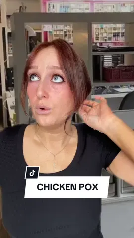 Marjorie is FUMING 🤬 #nursery #childcare #chickenpox 