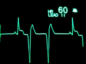 thời khắc một trái tim ngừng đập....