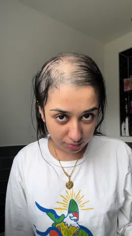 i hope these videos provide comfort for people experiencing hair loss. Know i feel your pain and im proud of you. Keep going 🤍🙏🏽 #fypシ #hairlossjourney #thaari 