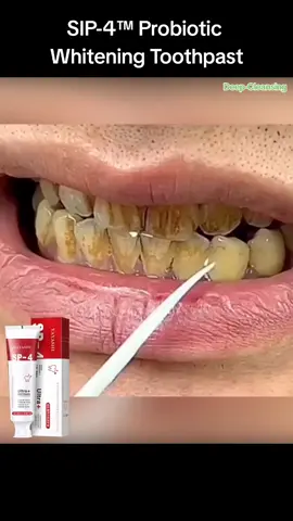 My friends always compliment me on my beautiful smile because I have white, clean teeth and ask me what I have done, this is how I explain it to them #BrightSmile #WhiteTeeth #DentalCare #ConfidenceBoost #HealthySmile #beautyroutine 