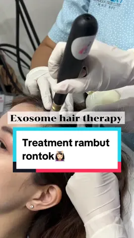 Salah satu treatment untuk rambut rontok adalah penggunaan exosome untuk menguatkan akar rambut sehingga mengurangi rambut rontok. Perlu dilakukan beberapa sesi untuk hasil yg maksimal. Setelah pengerjaan disarankan untuk tidak keramas selama 72 jam ke depan agar nutrisi yang diaplikasikan lebih menyerap✅💆🏻‍♀️ #hairfalltherapy #hairfallcontrol #rambutrontok #treatmentrambut #exosome 