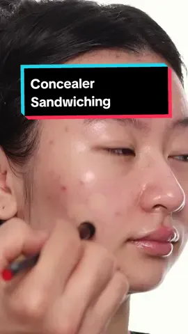 Concealer Sandwiching  I used Ben Nye Total Corrector Wheel NARS Soft Matte Complete Concealer Fenty Bauty Pro Filtr Foundation MAC Fix+ Ben Nye Banana Luxury Powder #concealertutorial #concealer #acnemakeup #fyp 