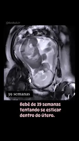 O espaço já está pequeno pra esse bebê!😬 #baby #maternidade #gestaçao #gravidez #prenatal #pregnant #tiktok 
