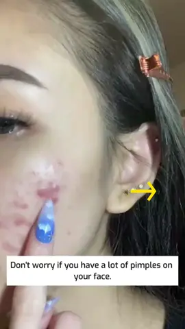 Very good product#vgo#beauty#exquisite#VC#yf#Essence