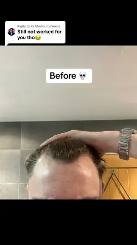 Replying to @Ya Mum but it did though 💀  #rosemaryoil #hair #hairline #tiktokshop 