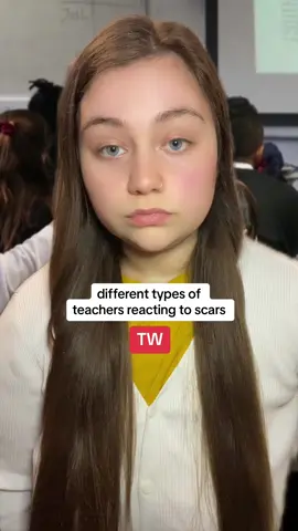 healed scars owe no one a trigger warning, don’t be ashamed of your body or your past 🤍 #cerysargent 