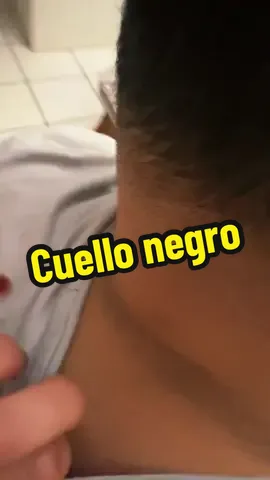 #parati #viral #fyp #quarxery #diabetes #skincareroutine 