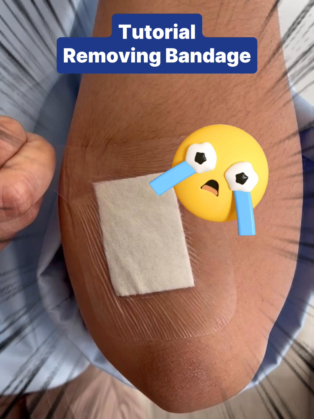 Let Hansaplast be your trusted guide for proper bandage removal! 🩹 Count on us to walk you through each step with care, guaranteeing a gentle and seamless experience. Your comfort is our priority, making bandage removal a breeze. ✨ Stay protected and worry-free with Hansaplast by your side today! 💙 #CleanseProtectHeal   #WeveGotYouCovered   #HansaplastSG