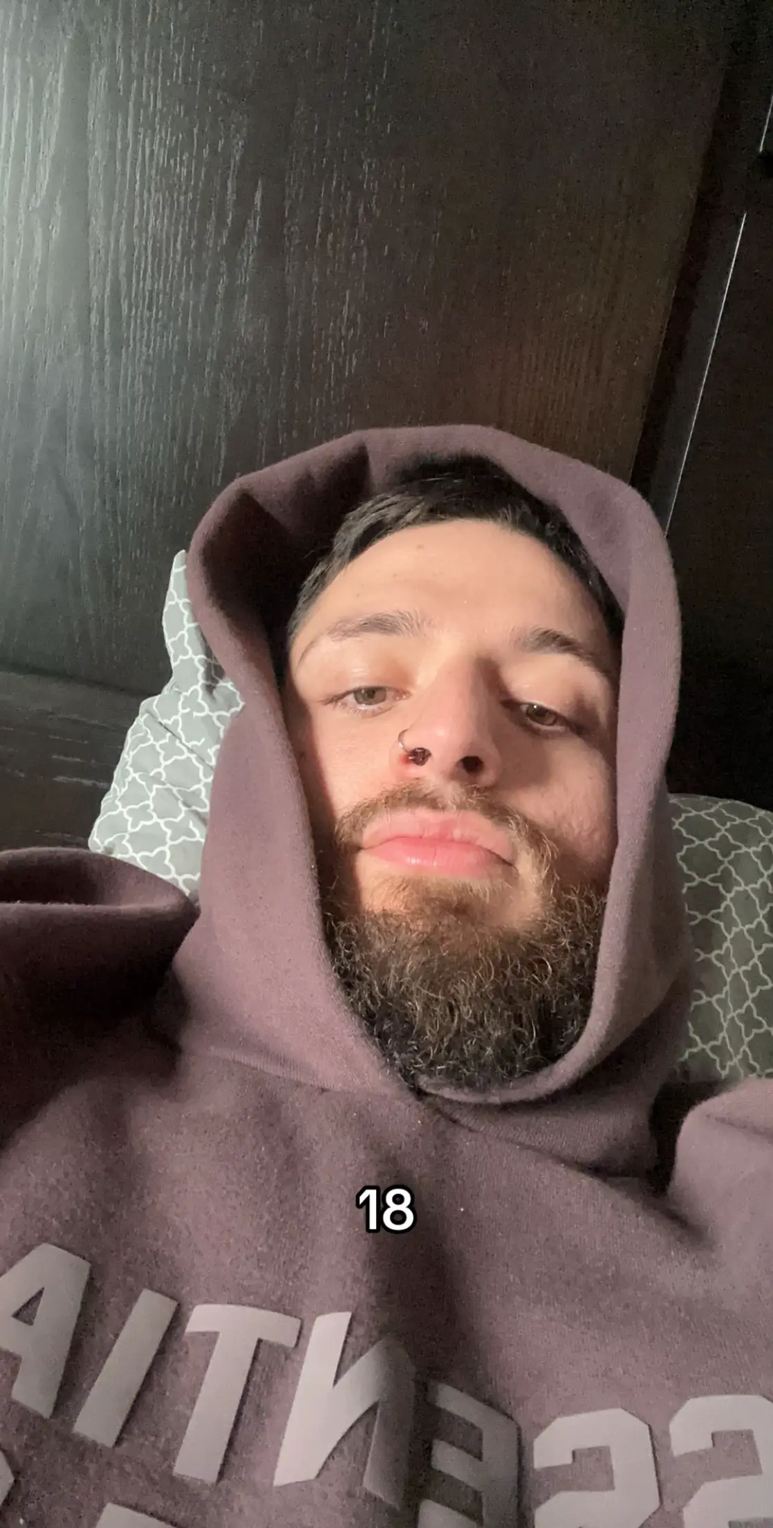 #🇦🇱 #fyp #viral 