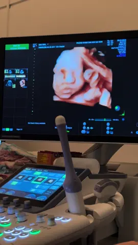 Siêu âm 5d #sanrongvang2024🥰🥰🍀🍀 #nhaviarongvang #xuhuong2024 #sieuamcanhtrung #xetnghiem #xetnghiem #chandoanhinhanh 