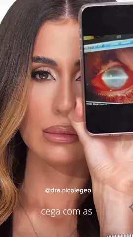 Já viu esse caso? A dentista Nicole Geo quase ficou cega em decorrência do mau uso das lentes de contato. O acompanhamento médico é indispensável na hora de optar pelo uso das lentes. Somente um médico oftalmologista saberá escolher o tipo de lente correto para cada necessidade, além de orientar sobre a maneira correta do manuseio e armazenamento das mesmas.
