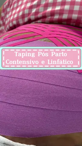 Aplicação de Taping pós parto Contensivo e Linfático. 💝🌸Avaliação personalizada e análise clínica. Técnica pode oferecer benefícios, como auxílio na redução do inchaço, estímulo à circulação linfática, alívio de desconfortos e suporte na recuperação muscular. É uma abordagem não invasiva que pode contribuir para uma recuperação mais eficaz e confortável após o parto. Sempre é aconselhável consultar um profissional de saúde para orientações personalizadas.  . Técnica desenvolvida pela enfermeira @cainhamelo 🔸 . #taping #pósparto #amamentação