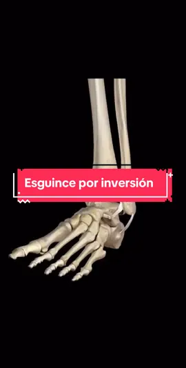 Aquí podemos observar como se produce un esguince por inversión donde estadísticamente se presenta mayor número de rupturas en el ligamento peroneoastragalino anterior. #fisio #lesiones #esguince #healthy #anatomy #fyp #3d 