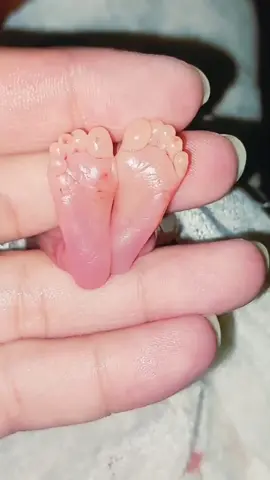 A very painful time when you see your child in this situation 😭😭#prematurebaby #birth #emotional #video #25weekspregnant #cutebaby #mother #pain #painful #uk #london #😭 #viral #video #fyp #fyp #fypシ #fypシ゚viral #foryou #foryourpage 