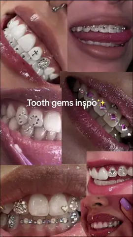 #CapCut #blackgirlmagic #foryou #trendingtiktok