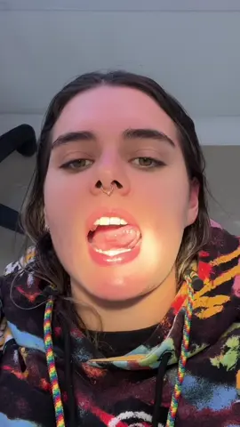 ¿Quieres hacer algo diferente para un evento especial, pero no quieres dañar tus dientes? Aqui en esplendent puedes atreverte a hacer algo diferente! #TuMejorImagen #festivalestereopicnic2024 #Joyasdentales 