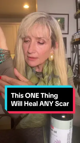 If you have ANY type of scar, this ONE THING is all you need to heal it! ❤️ #castoroil #scarcoverup #skinhealing #skinhealth #naturalhealing #naturalremedy #healthhacks 