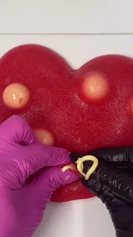 Best heart mochi pimple popping asmr Satisfying??  #asmrsounds #asmr #viral #fypシ #relax #skincare #mouthsounds #satisfying #tingles #asmrtriggers #mochipimplepopping #pimplepoppin #acnetreatment #asmrtiktoks #asmr_tingles #heart #asmrvideos 